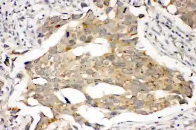 Anti-Prolactin Receptor antibody used in IHC (Paraffin sections) (IHC-P). GTX12307