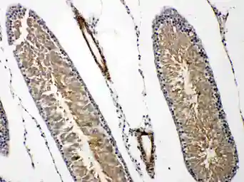 Anti-Prolactin Receptor antibody used in IHC (Paraffin sections) (IHC-P). GTX12307