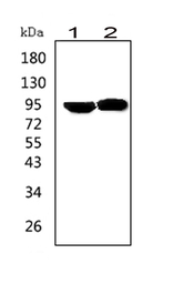 Anti-Prolactin Receptor antibody used in Western Blot (WB). GTX12307