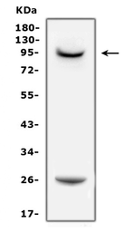 Anti-Prolactin Receptor antibody used in Western Blot (WB). GTX12307