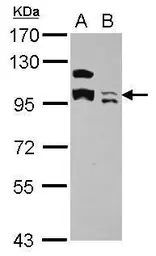 Anti-KCTD19 antibody used in Western Blot (WB). GTX123284