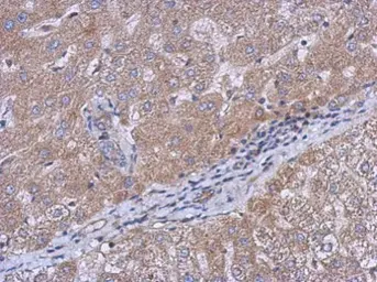 Anti-CERCAM antibody used in IHC (Paraffin sections) (IHC-P). GTX123293