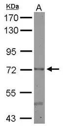 Anti-CERCAM antibody used in Western Blot (WB). GTX123293