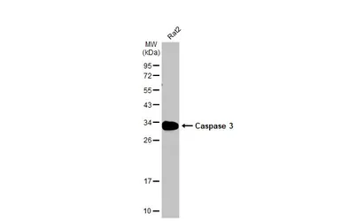 Anti-Caspase 3 antibody used in Western Blot (WB). GTX123678
