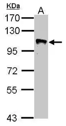 Anti-GRASP1 antibody [N3C2], Internal used in Western Blot (WB). GTX123753