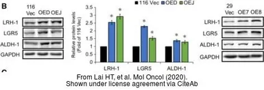 Anti-ALDH1A1 antibody used in Western Blot (WB). GTX123973