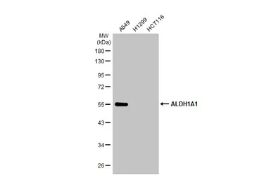 Anti-ALDH1A1 antibody used in Western Blot (WB). GTX123973