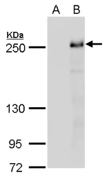 Anti-TET2 antibody [N2-2], N-term used in Western Blot (WB). GTX124205