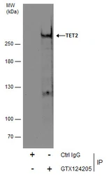 Anti-TET2 antibody [N2-2], N-term used in Immunoprecipitation (IP). GTX124205