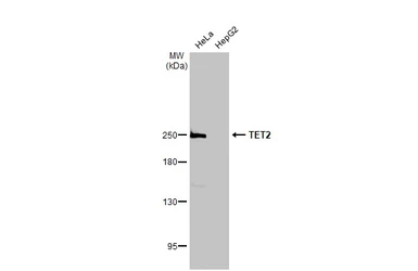 Anti-TET2 antibody [N2-2], N-term used in Western Blot (WB). GTX124205