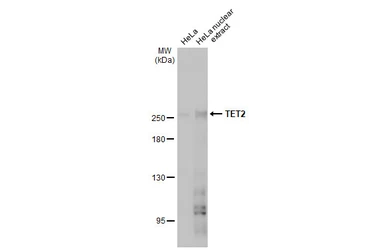 Anti-TET2 antibody [N2-2], N-term used in Western Blot (WB). GTX124205