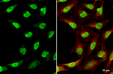 Anti-TET2 antibody [N2-2], N-term used in Immunocytochemistry/ Immunofluorescence (ICC/IF). GTX124205