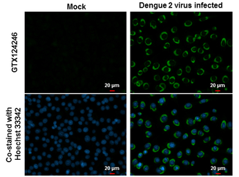 Anti-Dengue virus NS2B protein antibody used in Immunocytochemistry/ Immunofluorescence (ICC/IF). GTX124246