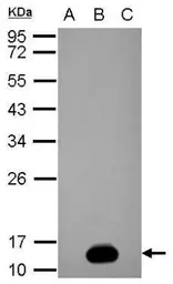 Anti-Dengue virus NS2B protein antibody used in Western Blot (WB). GTX124246