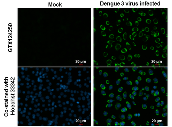 Anti-Dengue virus NS4B protein antibody used in Immunocytochemistry/ Immunofluorescence (ICC/IF). GTX124250