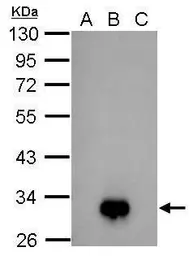 Anti-Dengue virus NS4B protein antibody used in Western Blot (WB). GTX124250