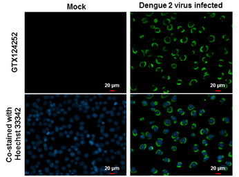 Anti-Dengue virus NS3 protein antibody used in Immunocytochemistry/ Immunofluorescence (ICC/IF). GTX124252