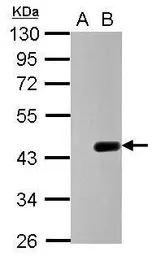 Anti-Maltose binding protein antibody used in Western Blot (WB). GTX124267