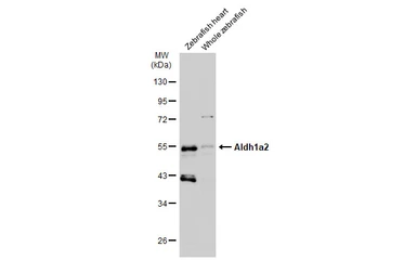 Anti-Aldh1a2 antibody used in Western Blot (WB). GTX124302