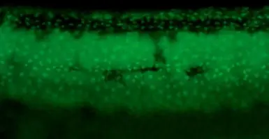 Anti-Tp63 antibody used in IHC (Whole mount) (IHC-Wm). GTX124660