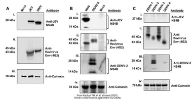 Anti-Japanese encephalitis virus NS4B antibody used in Western Blot (WB). GTX125865