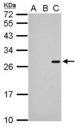 Anti-Japanese encephalitis virus NS4B antibody used in Western Blot (WB). GTX125865