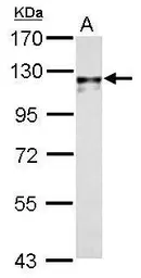 Anti-Cdh2 antibody used in Western Blot (WB). GTX125884