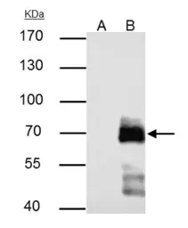 Anti-Paxillin antibody used in Immunoprecipitation (IP). GTX125891