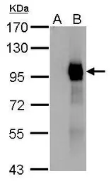 Anti-Paxillin antibody used in Western Blot (WB). GTX125891