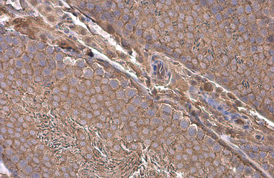 Anti-Paxillin antibody used in IHC (Paraffin sections) (IHC-P). GTX125891