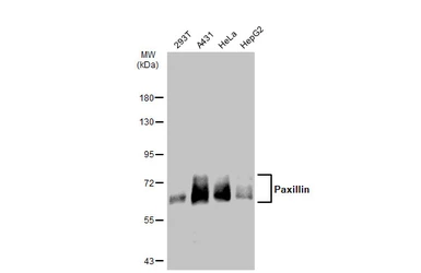 Anti-Paxillin antibody used in Western Blot (WB). GTX125891