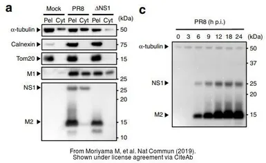 Anti-Influenza A virus NS1 (nonstructural protein) antibody used in Western Blot (WB). GTX125990