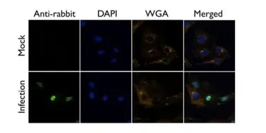 Anti-Influenza A virus NS1 (nonstructural protein) antibody used in Immunocytochemistry/ Immunofluorescence (ICC/IF). GTX125990