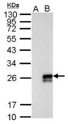 Anti-Influenza A virus NS1 (nonstructural protein) antibody used in Western Blot (WB). GTX125990