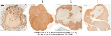 Anti-HIF1 alpha antibody used in IHC (Paraffin sections) (IHC-P). GTX127309