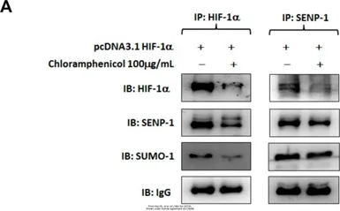 Anti-HIF1 alpha antibody used in Immunoprecipitation (IP). GTX127309