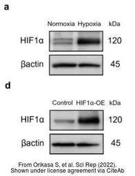 Anti-HIF1 alpha antibody used in Western Blot (WB). GTX127309