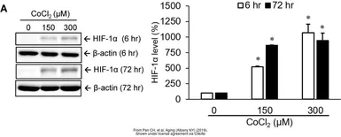 Anti-HIF1 alpha antibody used in Western Blot (WB). GTX127309