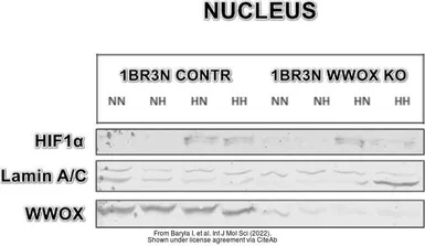 Anti-HIF1 alpha antibody used in Western Blot (WB). GTX127309