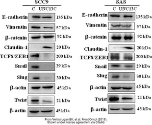 Anti-Twist1/2 antibody used in Western Blot (WB). GTX127310