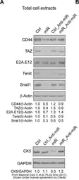 Anti-Twist1/2 antibody used in Western Blot (WB). GTX127310