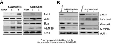 Anti-Twist1/2 antibody used in Western Blot (WB). GTX127310