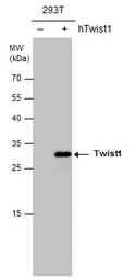 Anti-Twist1/2 antibody used in Western Blot (WB). GTX127310