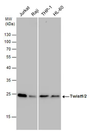 Anti-Twist1/2 antibody used in Western Blot (WB). GTX127310