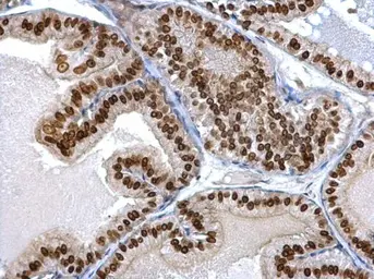 Anti-Twist1/2 antibody used in IHC (Paraffin sections) (IHC-P). GTX127310