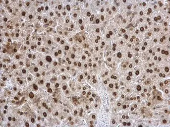 Anti-Twist1/2 antibody used in IHC (Paraffin sections) (IHC-P). GTX127310