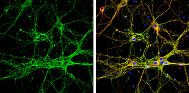 Anti-GAP43 antibody used in Immunocytochemistry/ Immunofluorescence (ICC/IF). GTX127937