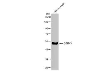 Anti-GAP43 antibody used in Western Blot (WB). GTX127937