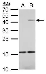 Anti-IL22 antibody used in Western Blot (WB). GTX127938