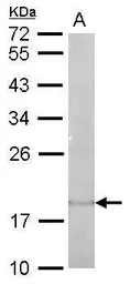 Anti-IL22 antibody used in Western Blot (WB). GTX127938